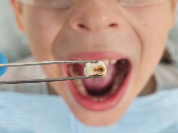 Best Broken Tooth Emergency  in Black River Falls, WI